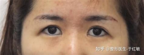 女人眼尾下垂面相|眼尾下垂耷拉眼的人面相上感情事业运势 命运风水面。